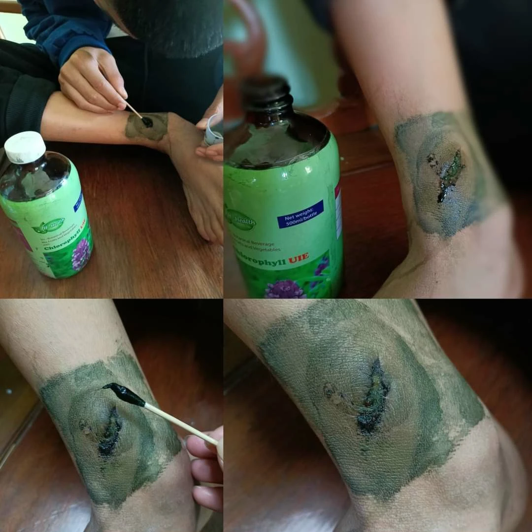 Hỏi đáp, đánh giá Diệp lục TH Health (Chlorophyll UIE PLUS) có tốt không? 18 Diệp lục TH Health đặc bôi trực tiếp lên vết thương, xử lý vết thương nhanh chóng, hiệu quả