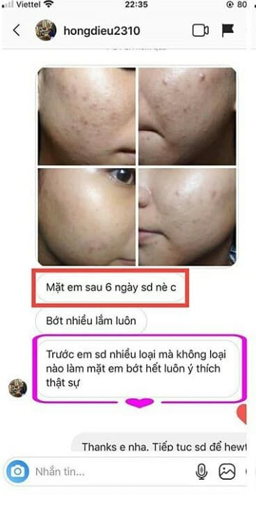hong dieu 20200506075944 - Tổng Kho MLM | Amway | Herbalife | Unicity | Droppii Biz